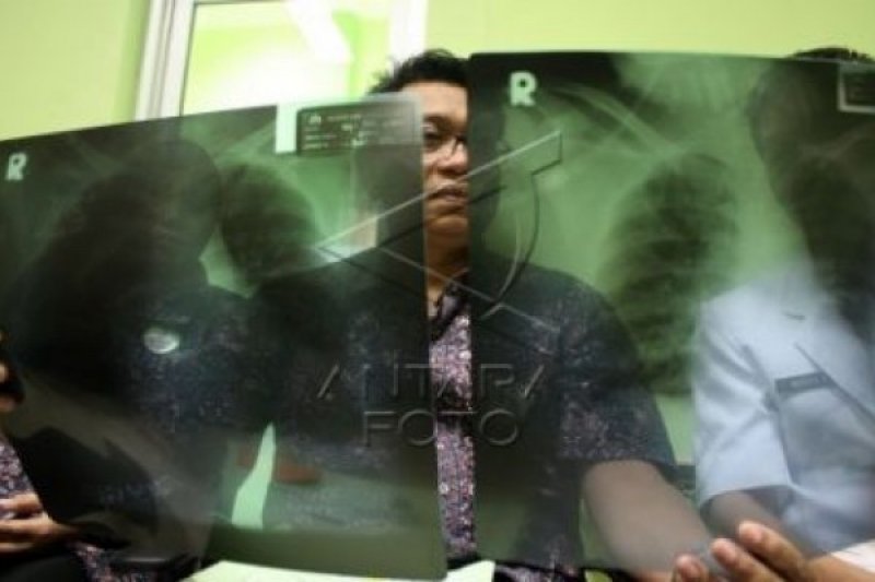 TEMUAN DIDUGA SUSPECT VIRUS MERS