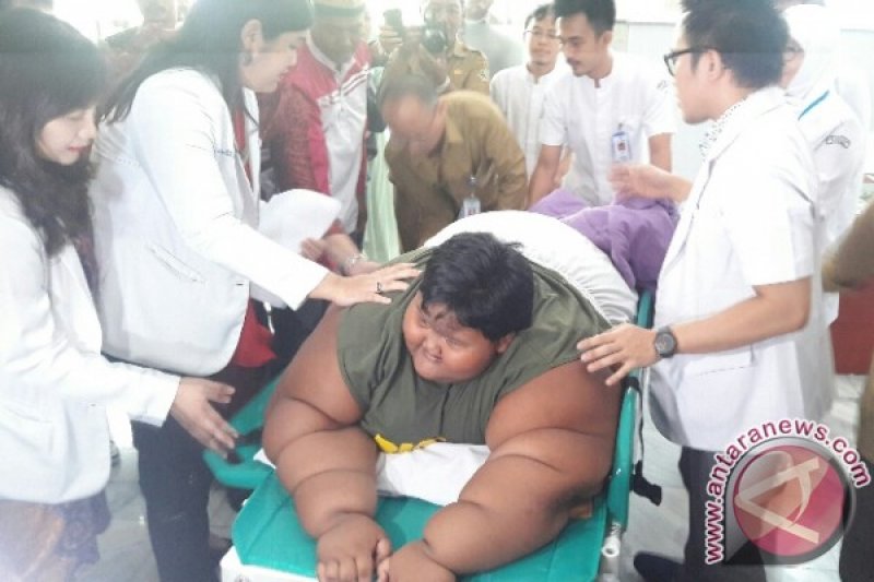 Bobot Arya Obesitas Turun 4 Kg  Berkat Diet di RSHS