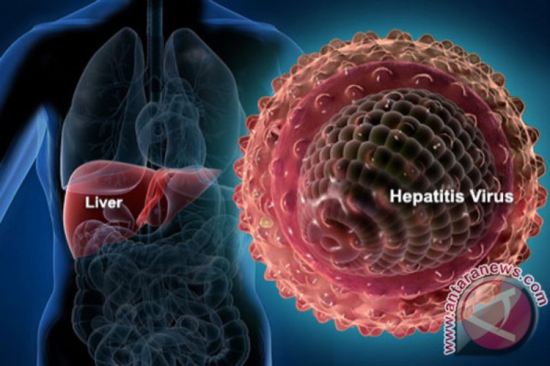 Kenali Hepatitis B, Penularan Hingga Pencegahannya - ANTARA News