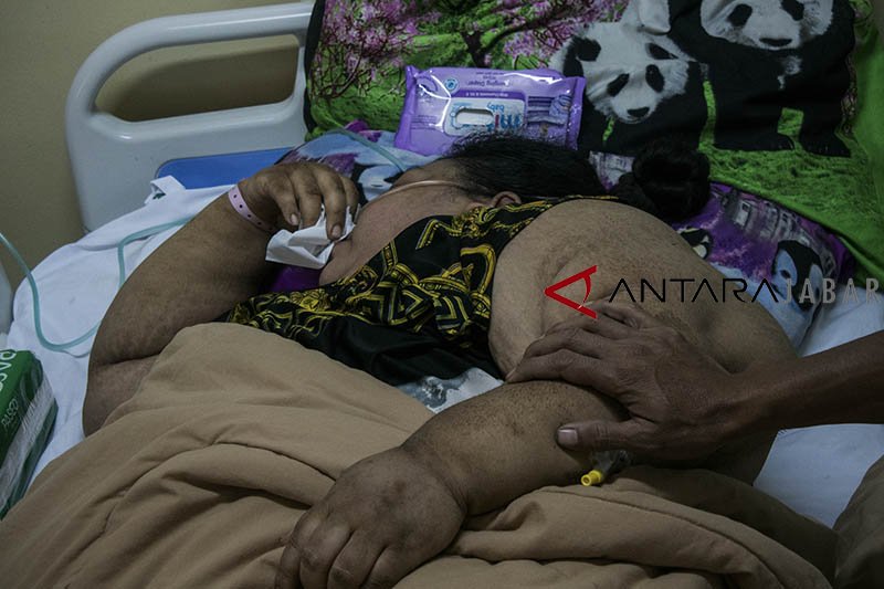 Sunarti, pasien obesitas asal Karawang meninggal dunia