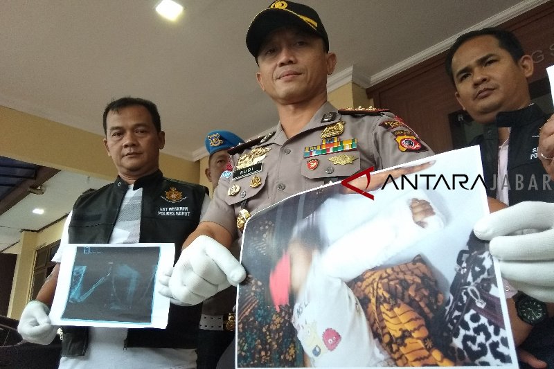 Ayah patahkan tangan anak kandung diamankan polisi