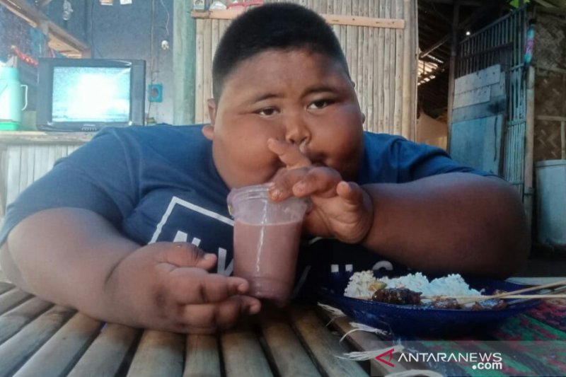 Obesitas capai 97 kg, orang tua berharap pemerintah bantu tangani anaknya