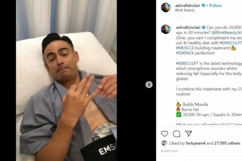 Ashraf Sinclair terapi "Emsculpt" sebelum meninggal