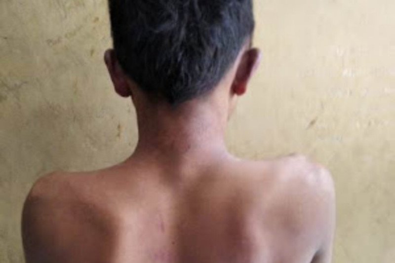 Berkat siaran langsung di medsos, nyawa pencuri motor terselamatkan