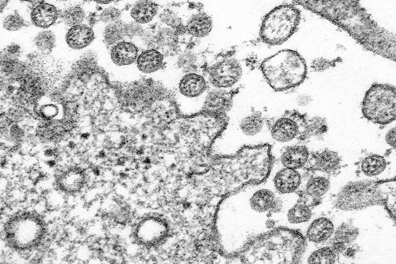Total kasus virus corona AS mencapai 2.063.812 dan 115.271 kematian