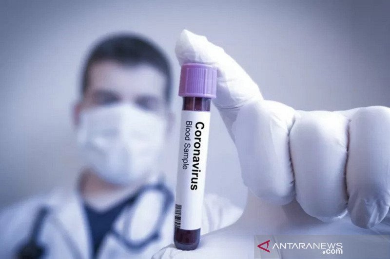 Laboratorium Amerika Serikat mulai uji antibodi COVID-19