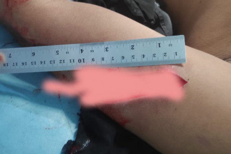 Tidak diberi jatah bulanan, preman di Sumbawa Barat bacok Ketua Pokdarwis Danau Lebo