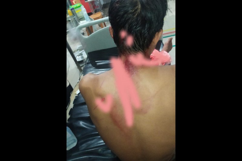 10 masuk puskesmas, satu keluarga berkelahi gegara sengketa lahan di Lombok Tengah