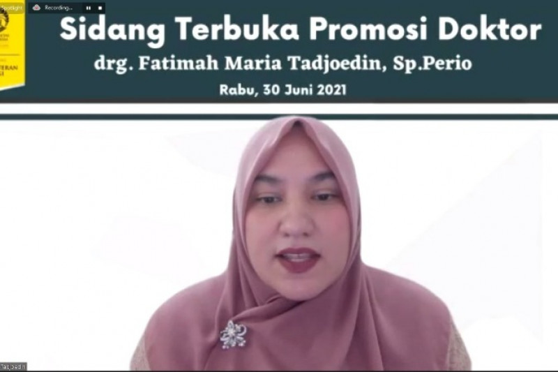 Fatimah Maria raih gelar Doktor FKG UI dengan nilai sempurna