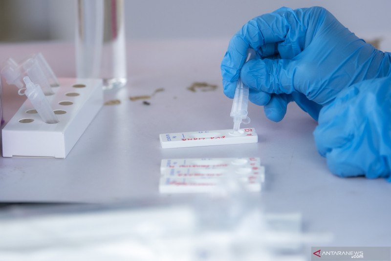PCR dan Antigen Negatif Syarat Wajib Bagi Peserta Tes SKD CPNS