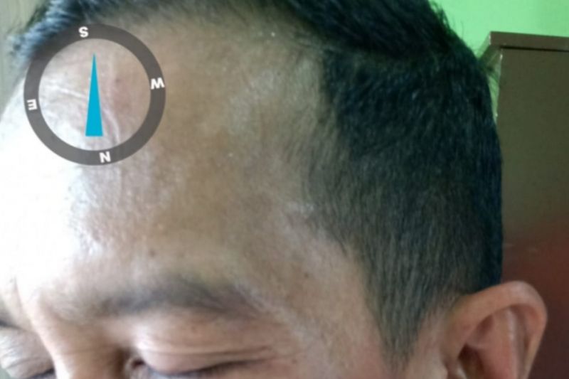 Anggotanya dipukuli saat meliput, Ketua PWI Dumai dampingi korban lapor polisi