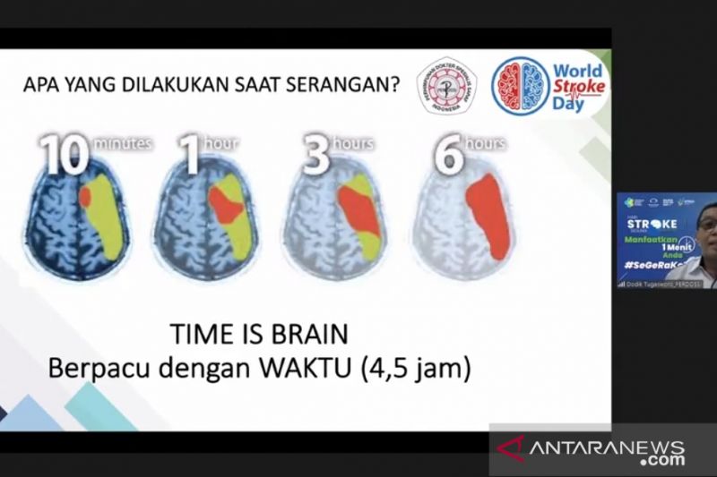 4,5 jam, waktu maksimal selamatkan serangan stroke