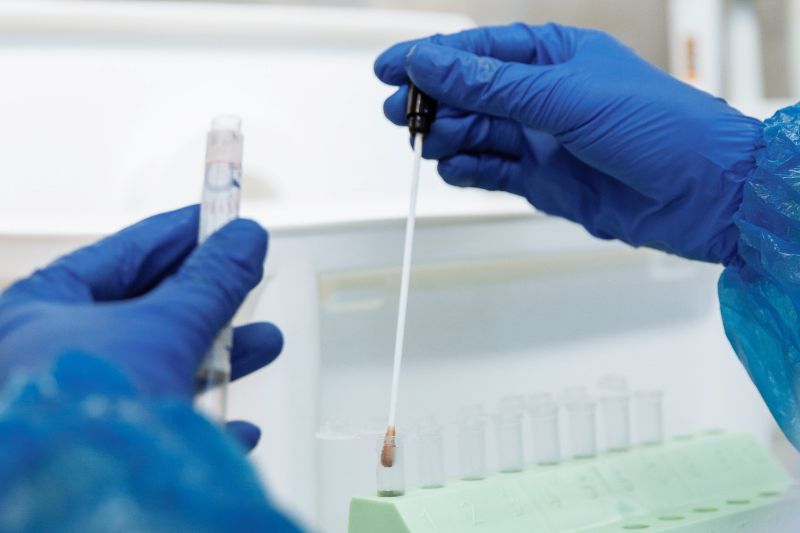 Cara kerja PCR 0+ untuk deteksi varian Omicron