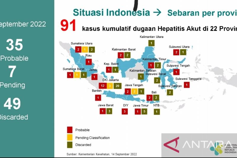 Kemenkes deteksi 91 kasus hepatitis akut misterius, Jabar satu kasus