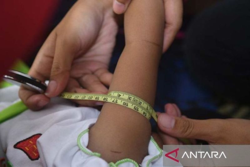 Dinkes Makassar: Anak stunting berisiko terpapar TBC