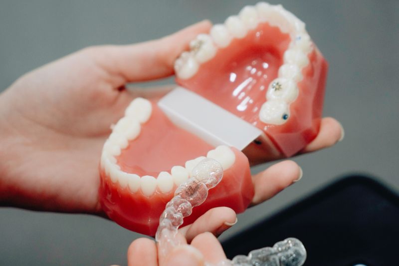 Kelebihan “clear aligners” dibandingkan kawat gigi