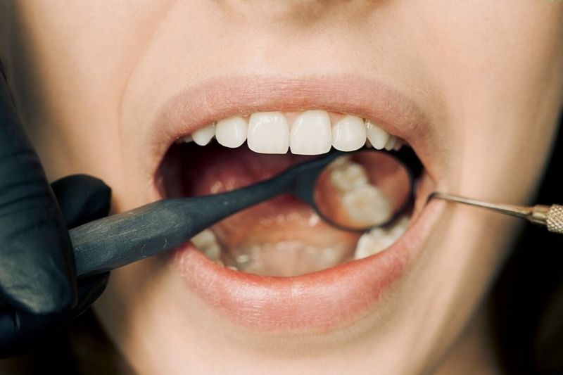 Tips jaga kesehatan gigi dan mulut selama berpuasa