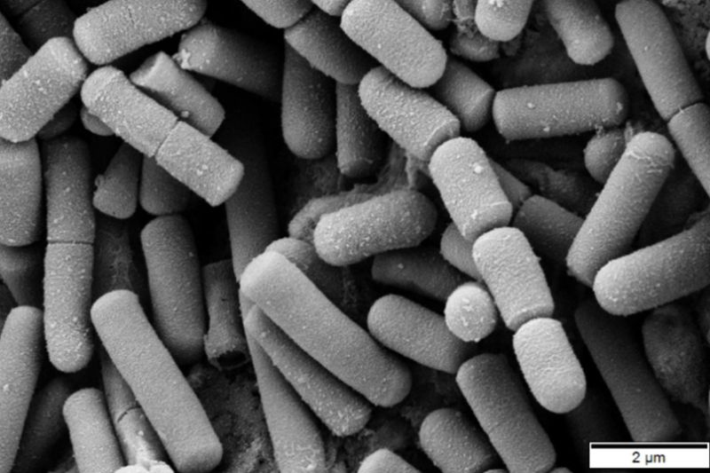Bakteri Bacillus Cereus picu keracunan cireng di Bandung Barat, sebut Dinkes