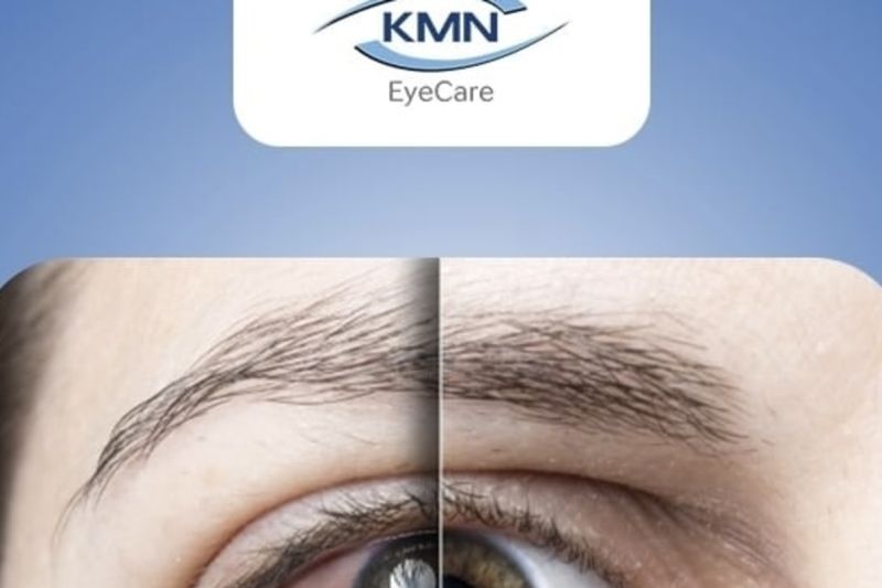 Teknologi SiLK hadir sebagai tindakan lasik mata tanpa flap