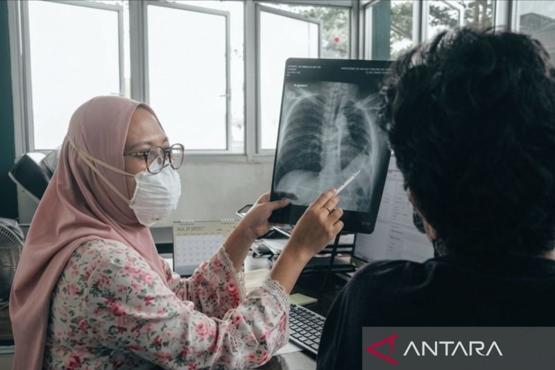 Paparan asap karhutla jangka panjang berisiko turunkan fungsi paru