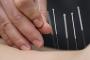 Akupuntur Bisa Sebarkan Hepatitis dan AIDS