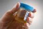 Urine Anggota Polwiltabes Makassar Positif Mengandung Amphetamine